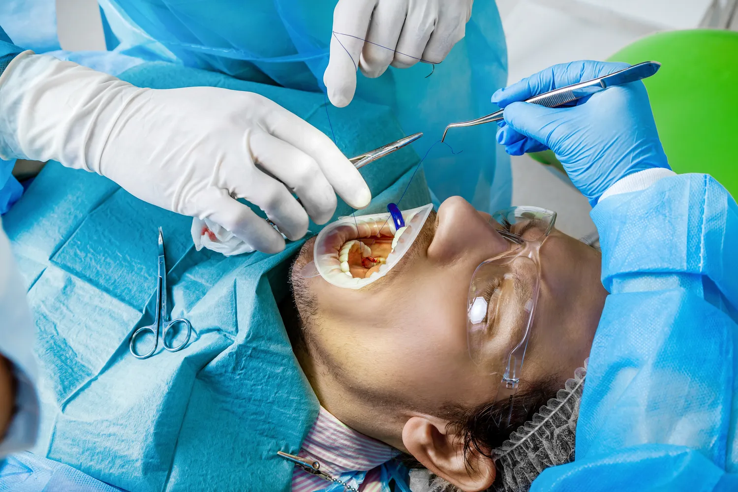 Implanty stomatologiczne Warszawa